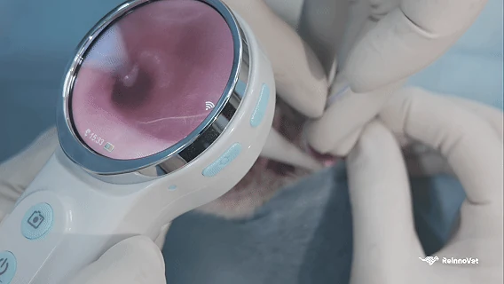 Bipolar Coagulation with the EP-300 system